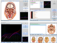 Spectrum Quantum 9d Nls Health Analyzer , Body Composition Analyser Machine