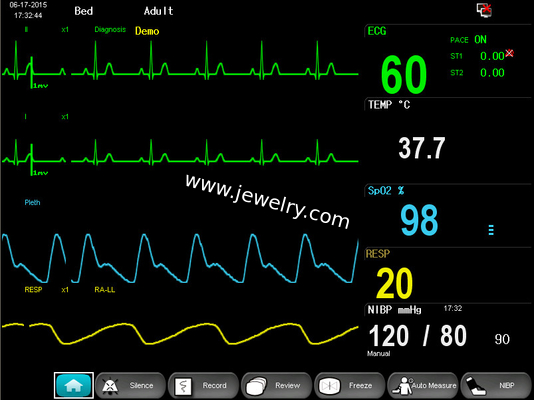 Dual-Channel 12 Inch High Definition Color TFT Display Standard 6-parameter E12 Modular Patient Monitor