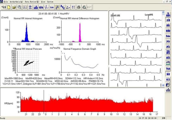 OLED display 48 Hours Recorder TLC6000 Dynamic 12 Lead ECG Holter Systems Recorder & Analysis Software