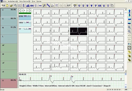 OLED display 48 Hours Recorder TLC6000 Dynamic 12 Lead ECG Holter Systems Recorder & Analysis Software