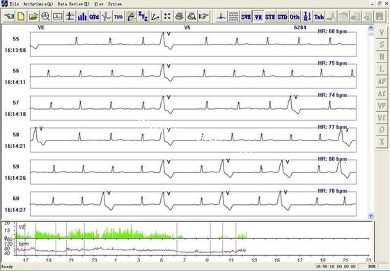 OLED display 48 Hours Recorder TLC6000 Dynamic 12 Lead ECG Holter Systems Recorder & Analysis Software