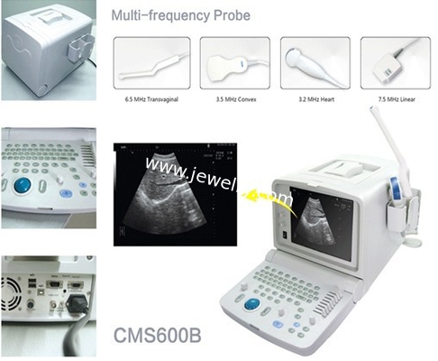 CMS600B B-Ultrasound Diagnostic Scanner