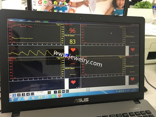 CMS50EW Bluetooth Wireless Finger tip pulse oximeter Blood Oxygen Saturation Monitor CMS50EW With USB Software OLED Scre
