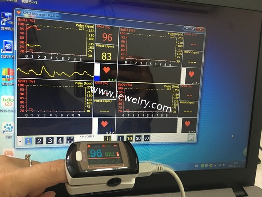 CMS50EW Bluetooth Wireless Finger tip pulse oximeter Blood Oxygen Saturation Monitor CMS50EW With USB Software OLED Scre